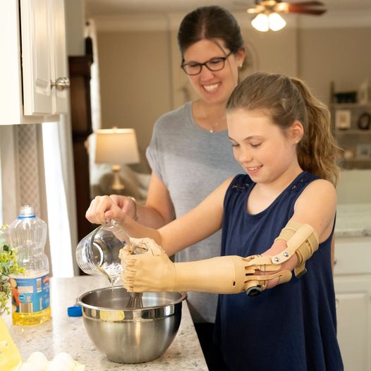 Diapo 4 : Photo d'une fille avec une prothèse de bras Unlimited Tomorrow qui cuisine avec sa mère