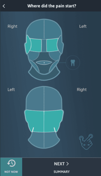 Diapo 3 : Page de l'application Migraine Buddy, où l'utilisateur indique où la douleur a commencé.