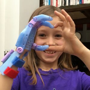 Petite fille qui fait un coeur avec ses mains dont une est une prothèse