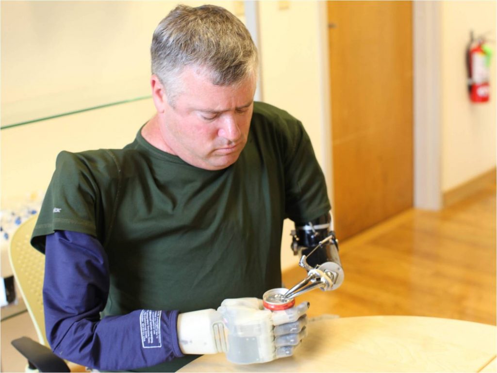 Diapo 3 : Revolutionizing-Prosthetics exemple de prothèse