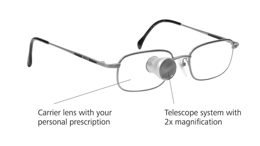 Diapo 4 : Photo du dispositif Zeiss G2 Bioptics sur un verre de lunette où il y a écrit ' verres porteurs avec votre prescription personnelle' et 'système de télescope avec grossissement 2 fois'