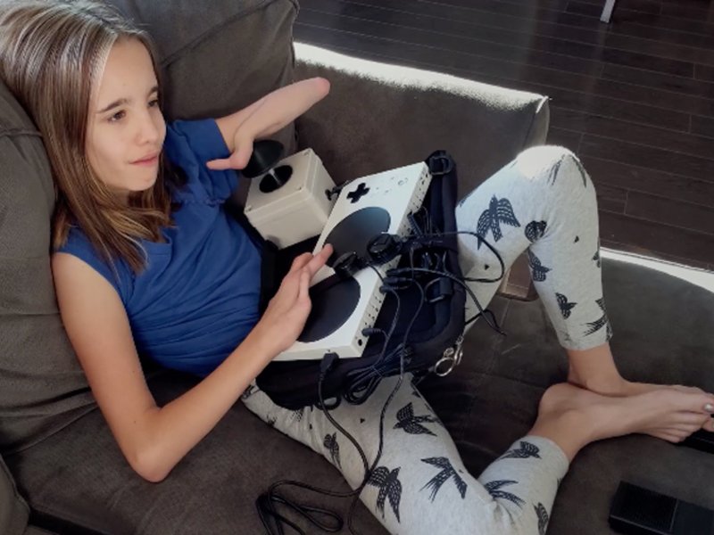 Diapo 4 : Fille ayant une malformation des doigts qui joue à la xbox avec la manette xbox adaptative controller