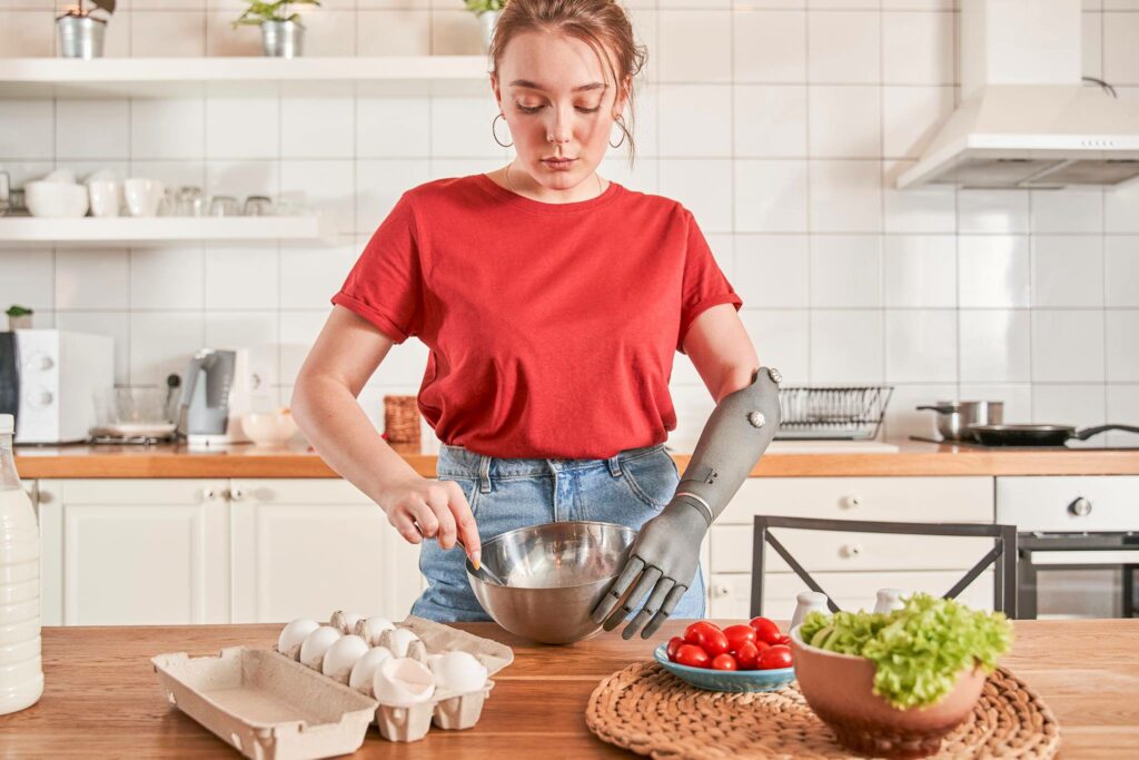 Diapo 5 : Femme ayant une prothèse au bras qui cuisine